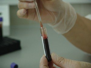 Donación de sangre