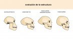 Australopithecus Australopithecus