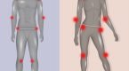 saber identificar la Fibromialgia